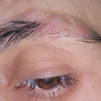 İdea Klinik Kaş Ekimi Hüsranı