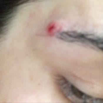 İdea Klinik Kaş Ekimi Hüsranı