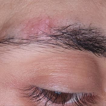 İdea Klinik Kaş Ekimi Hüsranı