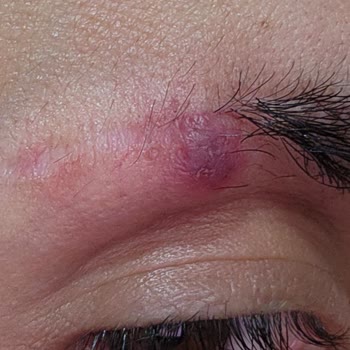 İdea Klinik Kaş Ekimi Hüsranı