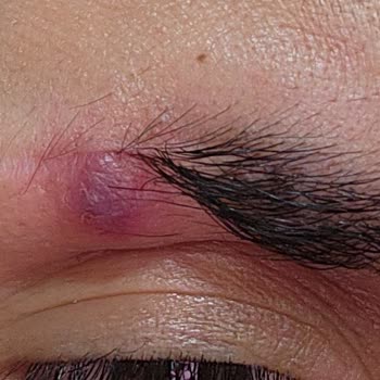 İdea Klinik Kaş Ekimi Hüsranı