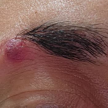 İdea Klinik Kaş Ekimi Hüsranı