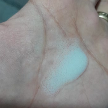 Milupa Bozuk Mama Satıp Hiç Yardımcı Olan Olmadı