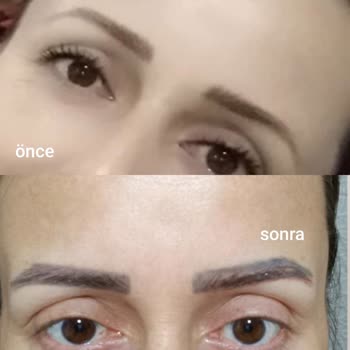 Eki aç