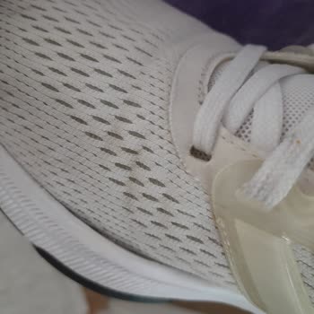 Adidas Spor Ayakkabı 3 Ayda Yanda Acil. A Oldu