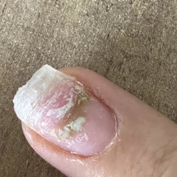 Solita Beauty Hijyen Asla Yok