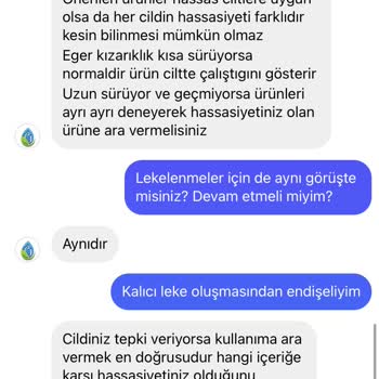 Rahik-i Mahtum Rahiki M Ürünleri Cildime Zarar Verdi-müşteri Temsilcisi Mağduriyeti