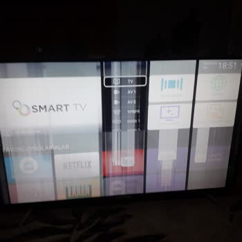 Onvo Televizyonun Geldiği Nokta