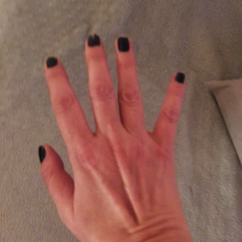 Maruderm Hyaluranic Acid Moisturizing Cream Yanma Kızarma Yaptı