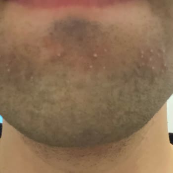 Philips 3000 Kişisel Bakım Ürününden Memnun Kalmadım