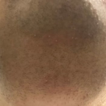 Philips 3000 Kişisel Bakım Ürününden Memnun Kalmadım