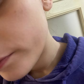 Watsons Bozuk Frudia Maske