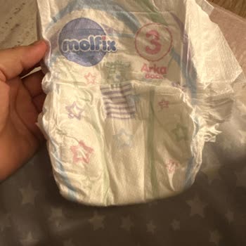 Molfix Kalitesi Değişmiş Sızdırıyor