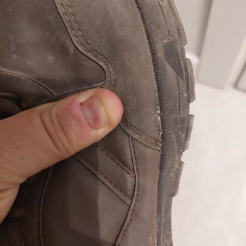 In Street Ve Kinetix Hatasını Kabul Etmiyor