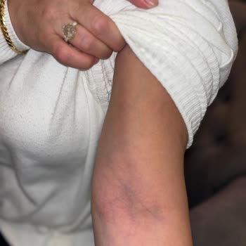 Başkent Üniversitesi Ankara Hastanesi Prof. Dr. Şikayetimiz