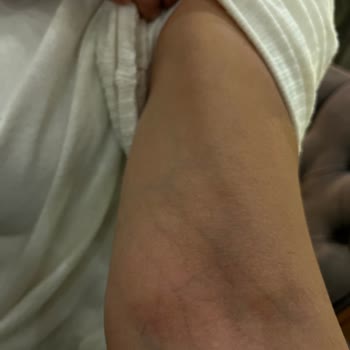 Başkent Üniversitesi Ankara Hastanesi Prof. Dr. Şikayetimiz