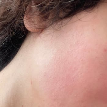 La Roche - Posay Hassas Ciltler İçin Yan Etki Uyarısı!