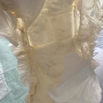 Sleepy Bezin İçindeki Siyah Noktalar