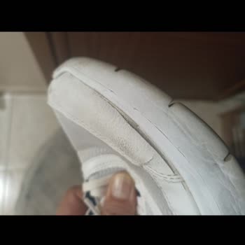 5 Ayda Yıpranan Skechers Ayakkabı!