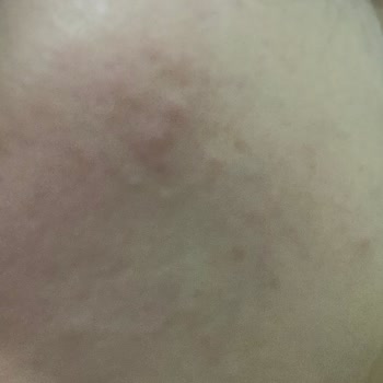 La Roche - Posay BB Güneş Kremi Yüzümü Mahvetti