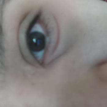 The NewLab. Göz Altı Serumu Kullanıcı Mağduriyeti