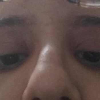 The NewLab. Göz Altı Serumu Kullanıcı Mağduriyeti