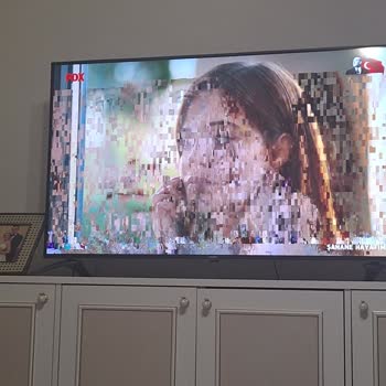 Fox Tv Karıncalanan Kesilen Yayın Problemi!