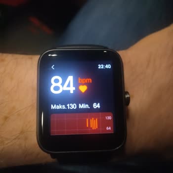 Vestel Akıllı Saat Şarj Problemi