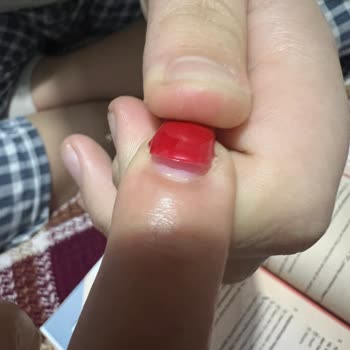 Eyüp Protez Tırnak Üç Günde Koptu