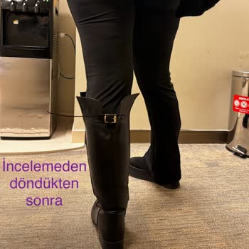 Pelinin Ayakkabıları- Kusurlu Malın Arkasında Durmuyor