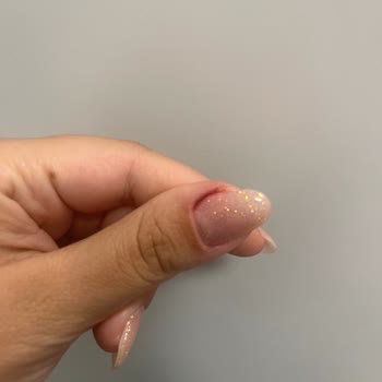 Eylül Öztürk Nail Spa Manikürde Elimi Kan İçinde Yara Bıraktılar