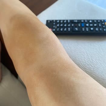 Amasya Üniversitesi Sabuncuoğlu Şerefeddin Eğitim ve Araştırma Hastanesi Yanlış Tedavi Sonucu Süren Ağrılarım