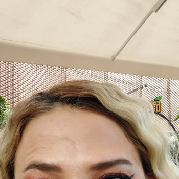 Suit Güzellik Merkezleri Hatalı Botoks İşlemi