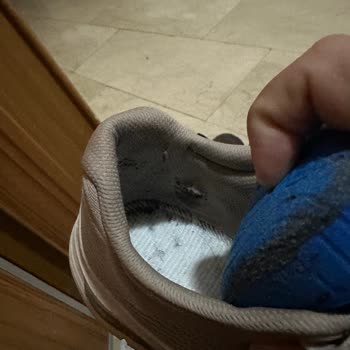 Skechers Ayıplı Malının Arkasında Durmuyor