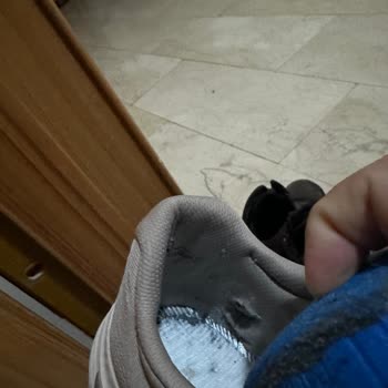 Skechers Ayıplı Malının Arkasında Durmuyor