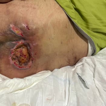 Epc Hastanesi EPC Hastanesinin Sorumsuzluğu