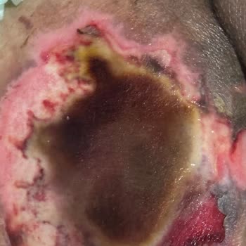 Epc Hastanesi EPC Hastanesinin Sorumsuzluğu