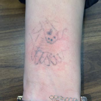 Tuğba Yeşilova Güzellik İadenin Yapılmasını İstiyorum