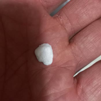 Balküpü Şeker Paketinde Beklenmedik Bulgu