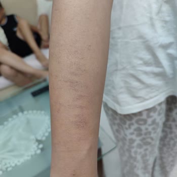 Aris Çukurambar Vip Lazer Epilasyon Hayal Kırıklığı