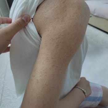 Aris Çukurambar Vip Lazer Epilasyon Hayal Kırıklığı