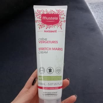 Mustela Çatlak Kremi Alerji Yaptı