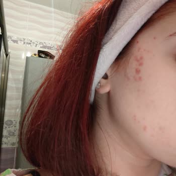 Farmareyon Güvenli Alışverişin Yüzümdeki Yıkıcı Etkisi