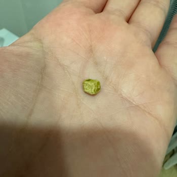 İmren Alaçatı Tatlıdan Çıkan Taş!