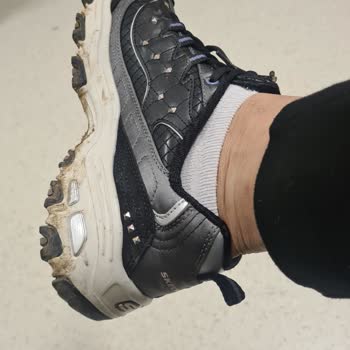 Skechers Kalıp Sorunu Mağduriyeti