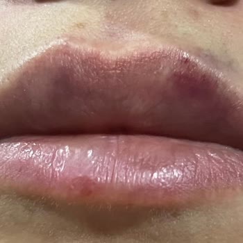 NÇ Beauty Center Nc Beauty Nevşehir