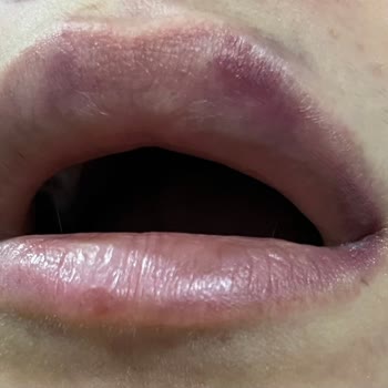 NÇ Beauty Center Nc Beauty Nevşehir