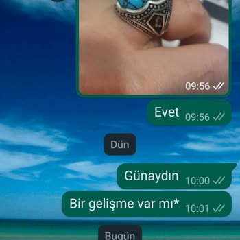 Anı Yüzük Tamir İçin Aksiyon Almıyor.