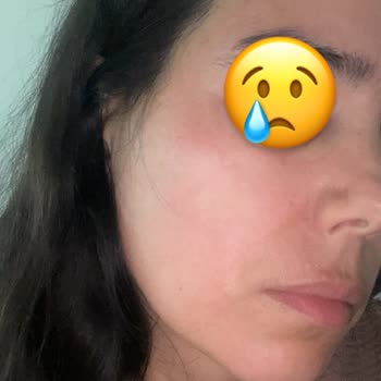 Claderm Çaldere Acındırıcı Kil Maskesi