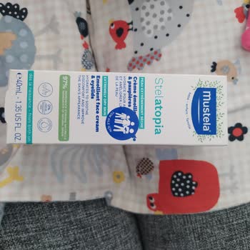 Mustela'nın Ürünleri Oğlumda Kabartı Ve Kızarıklık Yaptı!